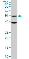 STK40 monoclonal antibody (M04), clone 4G3. Western blot of STK40 expression in HepG2.