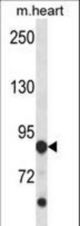 Mouse Cdkl5 Antibody western blot of mouse heart tissue lysates (35 ug/lane). The Cdkl5 antibody detected the Cdkl5 protein (arrow).