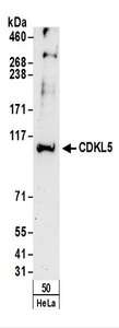 Detection of Human CDKL5 by Western Blot. Samples: Whole cell lysate (50 ug) from HeLa cells. Antibodies: Affinity purified rabbit anti-CDKL5 antibody used for WB at 0.4 ug/ml. Detection: Chemiluminescence with an exposure time of 3 minutes.