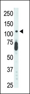 The anti-STK9 antibody is used in Western blot to detect STK9 in mouse lung tissue lysate.