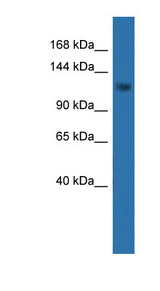 CDKL5 antibody LS-C135665 Western blot of 721_B cell lysate.