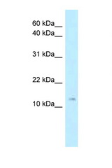 STMN1 antibody LS-C146152 Western blot of Mouse Thymus lysate. Antibody concentration 1 ug/ml.