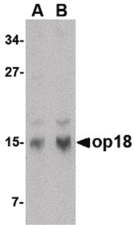 Western blot of op18 in human brain tissue lysate with op18 antibody at (A) 0.5 and (B) 1 ug/ml.