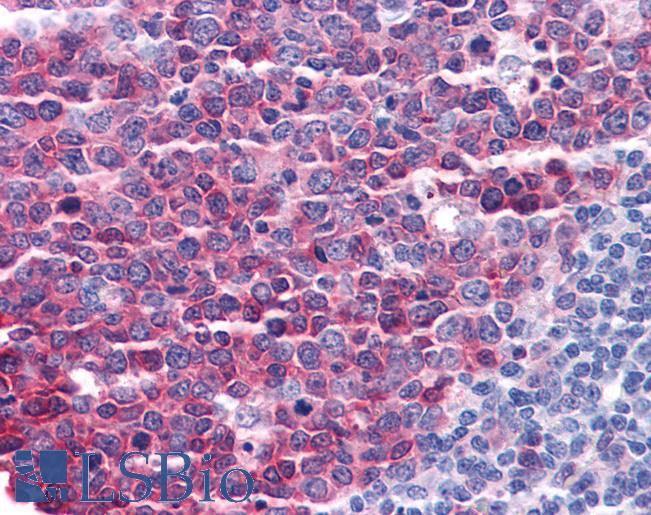 Anti-STMN1 antibody IHC of human tonsil. Immunohistochemistry of formalin-fixed, paraffin-embedded tissue after heat-induced antigen retrieval. Antibody LS-B4328 concentration 3.75 ug/ml.