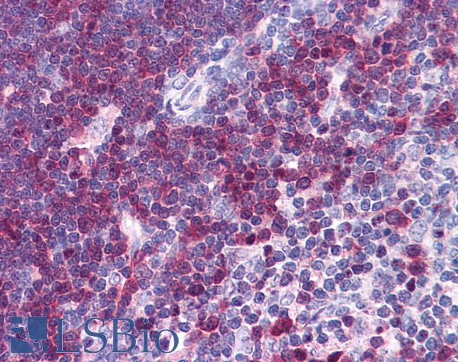 Anti-STMN1 antibody IHC of human thymus. Immunohistochemistry of formalin-fixed, paraffin-embedded tissue after heat-induced antigen retrieval. Antibody LS-B4328 concentration 3.75 ug/ml.