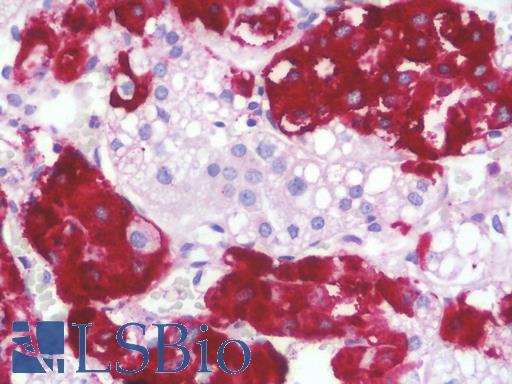 Anti-STMN4 / RB3 antibody IHC staining of human adrenal. Immunohistochemistry of formalin-fixed, paraffin-embedded tissue after heat-induced antigen retrieval. Antibody LS-B9876 concentration 10 ug/ml.
