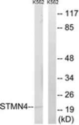 Western blot of extracts from K562 cells, using STMN4 Antibody. The lane on the right is treated with the synthesized peptide.