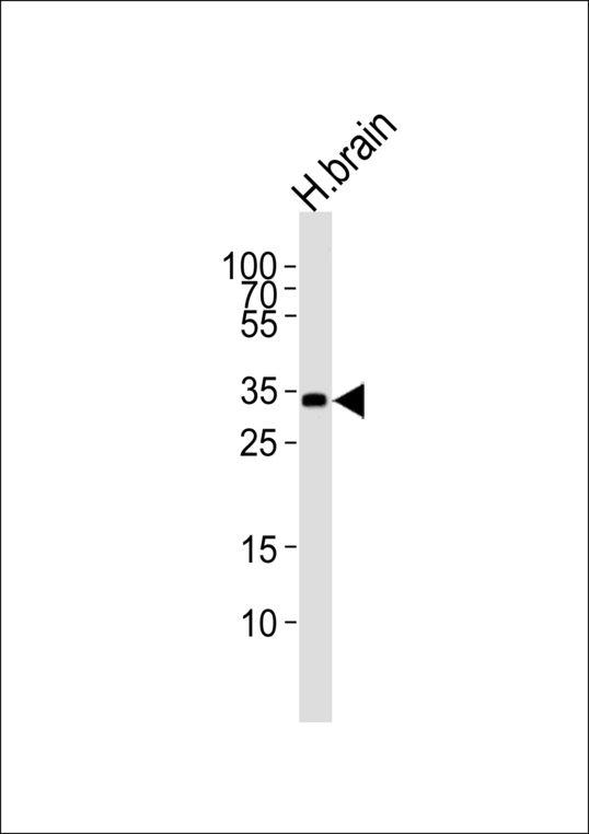 Western blot of lysate from human brain tissue lysate, using STMN4 Antibody. Antibody was diluted at 1:1000 at each lane. A goat anti-rabbit IgG H&L (HRP) at 1:5000 dilution was used as the secondary antibody. Lysate at 35ug per lane.