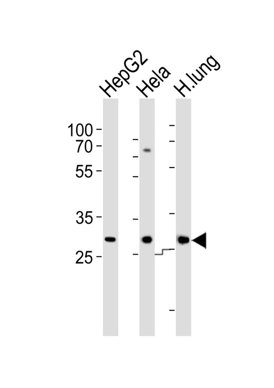 Western blot of lysates from HepG2, HeLa cell line and human lung tissue lysate (from left to right) with STOM Antibody. Antibody was diluted at 1:1000 at each lane. A goat anti-rabbit IgG H&L (HRP) at 1:5000 dilution was used as the secondary antibody. Lysates at 35 ug per lane.