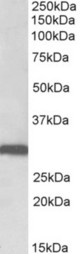 STOM antibody (0.1 ug/ml) staining of Human Lung lysate (35 ug protein in RIPA buffer). Primary incubation was 1 hour. Detected by chemiluminescence.
