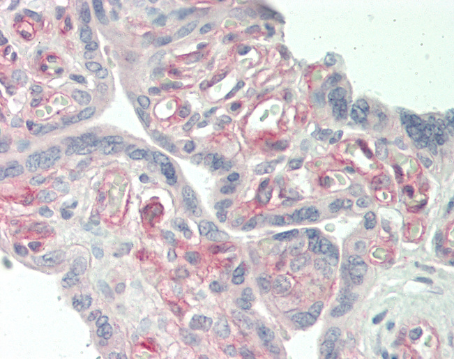 Human Placenta: Formalin-Fixed, Paraffin-Embedded (FFPE)