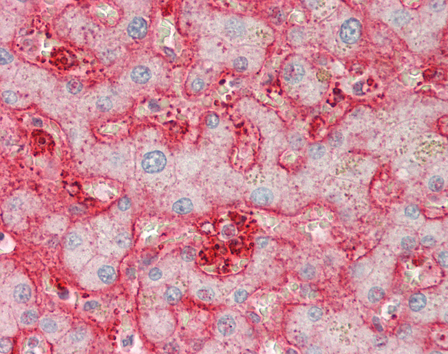 Human Liver: Formalin-Fixed, Paraffin-Embedded (FFPE)