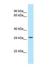 STOM antibody LS-C145993 Western blot of HeLa Cell lysate. Antibody concentration 1 ug/ml.