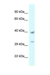 STOML2 antibody LS-C145473 Western blot of 721_B Cell lysate. Antibody concentration 1 ug/ml.