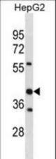STOML2 Antibody western blot of HepG2 cell line lysates (35 ug/lane). The STOML2 antibody detected the STOML2 protein (arrow).