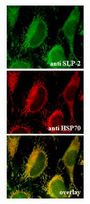 Endogenous SLP-2 is localized to the mitochondria (Immunocytochemical staining). . Endogenous SLP-2 (green) (up) and endogenous mitochondrial HSP70 (red) (middle) were detected in methanol fixed HeLa cells using anti-SLP-2, pAb (1:100) and a pAb to mitochondrial HSP70, respectively. . Picture courtesy of Dr. Sandrine Da Cruz, University of Geneva.