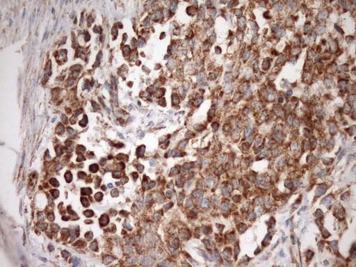 IHC of paraffin-embedded Human bladder tissue using anti-STOML2 mouse monoclonal antibody. (Heat-induced epitope retrieval by Tris-EDTA, pH8.0)(1:150).