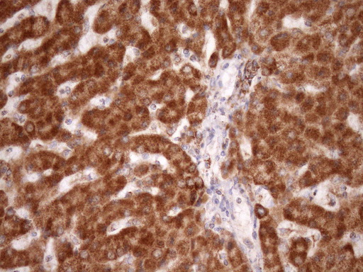 IHC of paraffin-embedded Human liver tissue using anti-STOML2 mouse monoclonal antibody. (Heat-induced epitope retrieval by Tris-EDTA, pH8.0)(1:150).