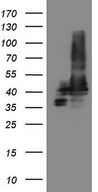 HEK293T cells were transfected with the pCMV6-ENTRY control (Left lane) or pCMV6-ENTRY STOML2 (Right lane) cDNA for 48 hrs and lysed. Equivalent amounts of cell lysates (5 ug per lane) were separated by SDS-PAGE and immunoblotted with anti-STOML2 (1:2000).