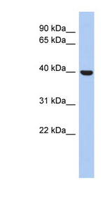 STOML3 antibody LS-C111435 Western blot of 721_B cell lysate.