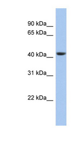 STOML3 antibody LS-C111436 Western blot of 721_B cell lysate.