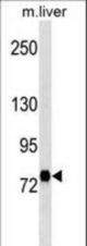 Rat Stra6 Antibody western blot of mouse liver tissue lysates (35 ug/lane). The Stra6 antibody detected the Stra6 protein (arrow).