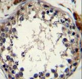 STRA8 Antibody immunohistochemistry of formalin-fixed and paraffin-embedded human testis tissue followed by peroxidase-conjugated secondary antibody and DAB staining.
