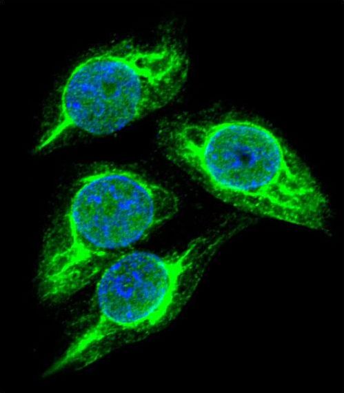 Confocal immunofluorescent of STRA8 Antibody with 293 cell followed by Alexa Fluor 488-conjugated goat anti-rabbit lgG (green). DAPI was used to stain the cell nuclear (blue).
