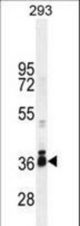 STRA8 Antibody western blot of 293 cell line lysates (35 ug/lane). The STRA8 antibody detected the STRA8 protein (arrow).