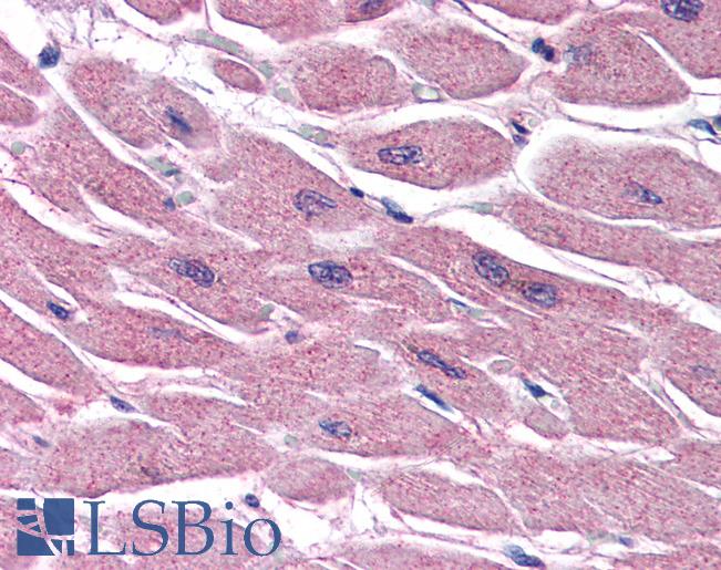 Anti-STRADB antibody IHC of human heart. Immunohistochemistry of formalin-fixed, paraffin-embedded tissue after heat-induced antigen retrieval. Antibody LS-B2747 concentration 75 ug/ml.