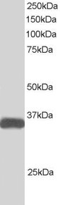 Antibody staining (1 ug/ml) of Human Heart lysate (RIPA buffer, 30 ug total protein per lane). Primary incubated for 1 hour. Detected by Western blot of chemiluminescence.