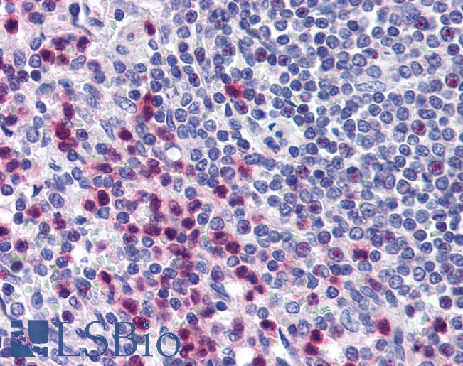 Anti-STRAP antibody IHC of human spleen. Immunohistochemistry of formalin-fixed, paraffin-embedded tissue after heat-induced antigen retrieval. Antibody LS-B1803 concentration 10 ug/ml.