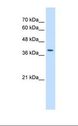 HepG2 cell lysate. Antibody concentration: 2.5 ug/ml. Gel concentration: 12%.