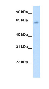 STS antibody LS-C40344 Western blot of Placenta lysate.