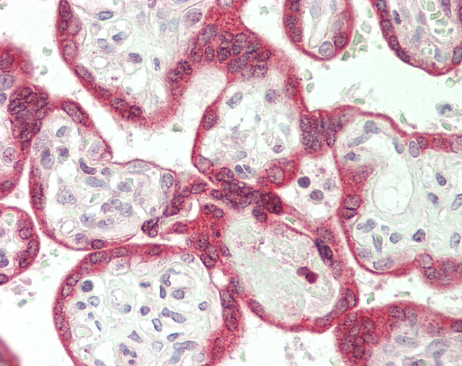 Human Placenta: Formalin-Fixed, Paraffin-Embedded (FFPE)