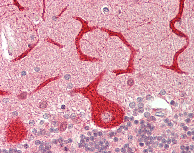Human Brain, Cerebellum: Formalin-Fixed, Paraffin-Embedded (FFPE)