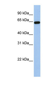 STS antibody LS-C101925 Western blot of Placenta lysate.