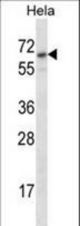 STS Antibody western blot of HeLa cell line lysates (35 ug/lane). The STS antibody detected the STS protein (arrow).