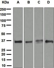 Western blot analysis on (A) HeLa, (B) MCF-7, (C) ECV-304, and (D) 293T cell lysates using anti-STUB1 antibody.