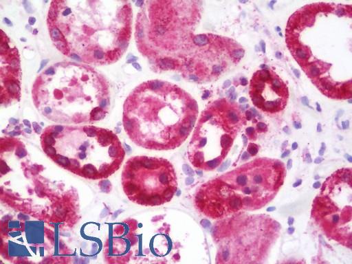 Anti-STUB1 / CHIP antibody IHC staining of human kidney. Immunohistochemistry of formalin-fixed, paraffin-embedded tissue after heat-induced antigen retrieval. Antibody LS-B11048 dilution 1:100.