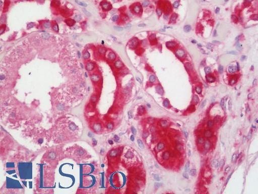 Human Kidney: Formalin-Fixed, Paraffin-Embedded (FFPE)