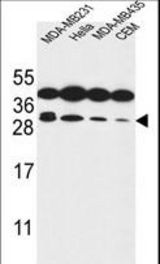 STX10 Antibody western blot of MDA-MB231,HeLa,MDA-MB435,CEM cell line lysates (35 ug/lane). The STX10 antibody detected the STX10 protein (arrow).