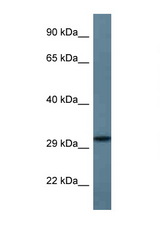 STX11 antibody LS-C145328 Western blot of Fetal Heart lysate. Antibody concentration 1 ug/ml.