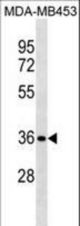 STX11 Antibody western blot of MDA-MB453 cell line lysates (35 ug/lane). The STX11 antibody detected the STX11 protein (arrow).