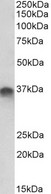STX11 antibody (1 ug/ml) staining of Placenta lysate (35 ug protein in RIPA buffer). Primary incubation was 1 hour. Detected by chemiluminescence.