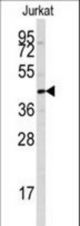 Western blot of anti-PTPN7 Antibody (S44) in Jurkat cell line lysates (35 ug/lane). PTPN7 (arrow) was detected using the purified antibody.