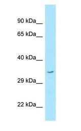STX16 / Syntaxin 16 antibody Western Blot of Fetal Kidney.
