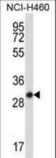 STX17 Antibody western blot of NCI-H460 cell line lysates (35 ug/lane). The STX17 antibody detected the STX17 protein (arrow).