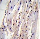 STX19 Antibody immunohistochemistry of formalin-fixed and paraffin-embedded m.heart tissue followed by peroxidase-conjugated secondary antibody and DAB staining.
