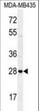 STX19 Antibody western blot of MDA-MB435 cell line lysates (35 ug/lane). The STX19 antibody detected the STX19 protein (arrow).